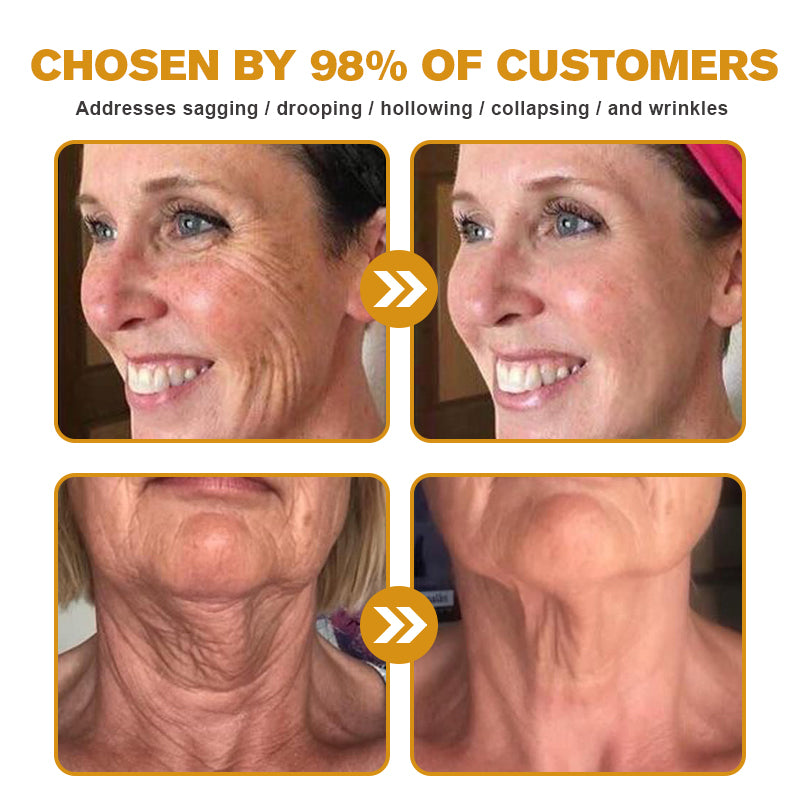 Crema para eliminar arrugas con veneno de abeja y botox